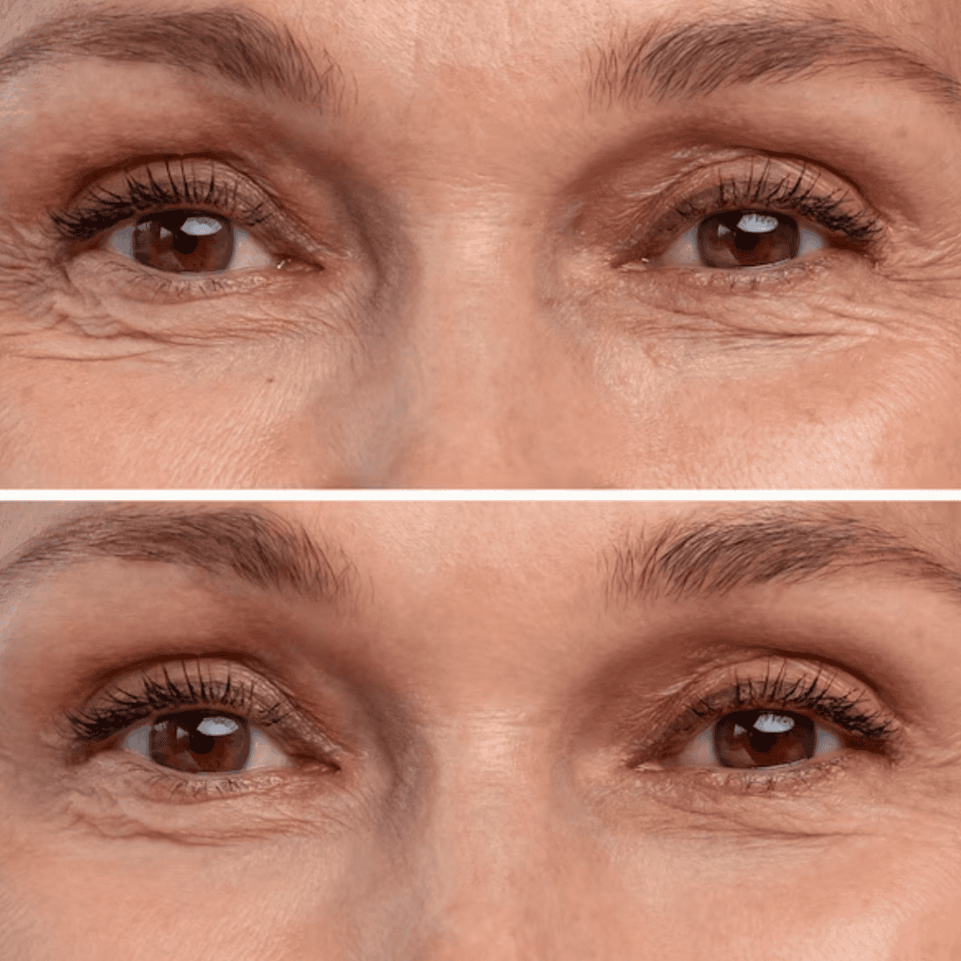 Siero viso al collagene (30ml)